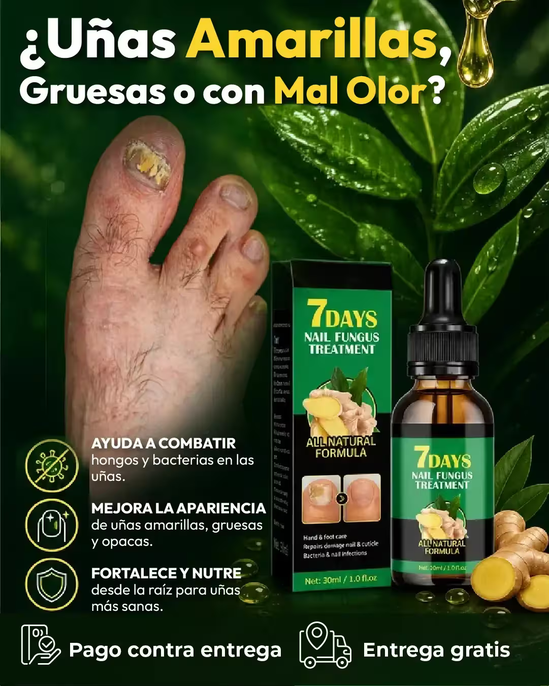 Aceite para Hongos de Uñas 30ml